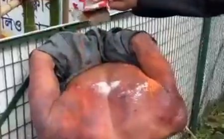 ধর্মনগরে যুবকের উপর নৃশংস অত্যাচার, পুলিশের কঠোর পদক্ষেপ চায় জনতা