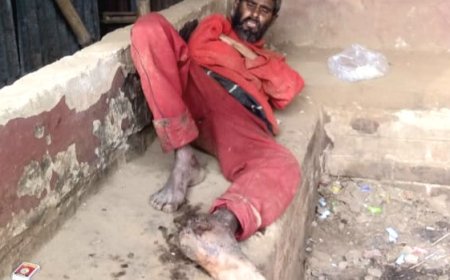 পায়ে ক্ষত, বেড়ীমুড়ায় পচন যন্ত্রণায় কাতরাচ্ছেন ভবঘুরে