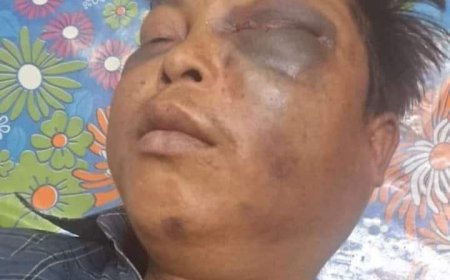 পুলিশের মারে নিহত যুবকের লাশ নিয়ে মনু থানা ঘেরাও